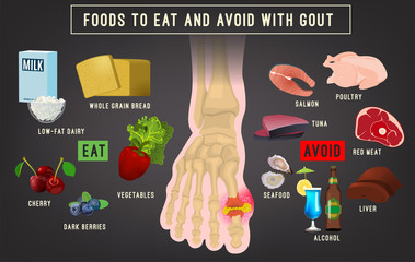 Gouty Arthritis causes